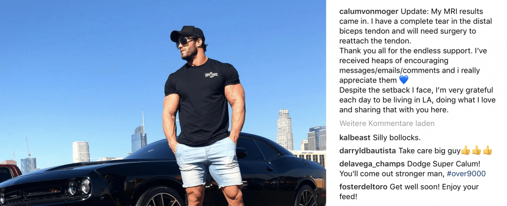 Calum von Moger Bizeps OP